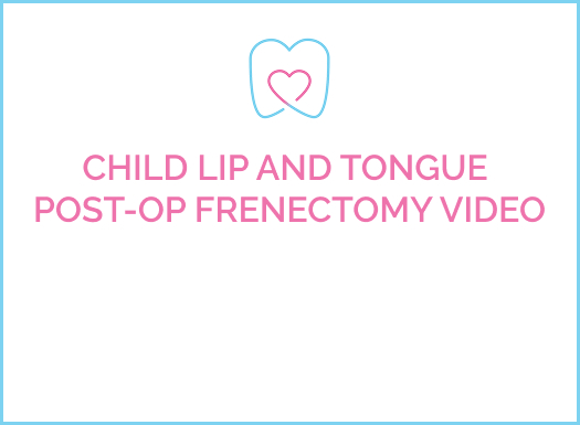 Grand Rapids Pediatric Dentists Child Lip And Tongue Post Op Frenectomy